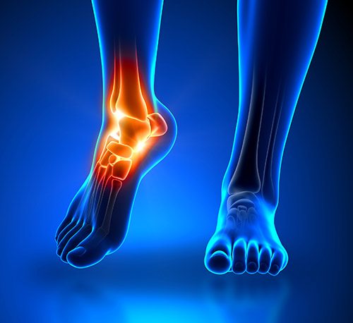 Ankle Joint
